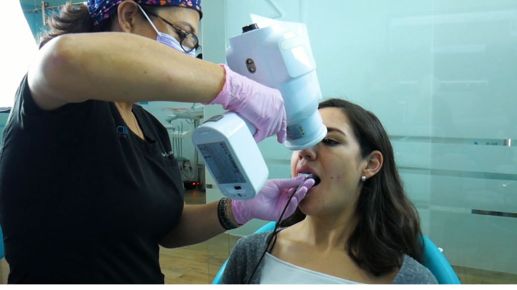 Se presenta la última tecnología en guardas dentales invisalign en La Clínica Dental Camara La clinica dental 1024x576